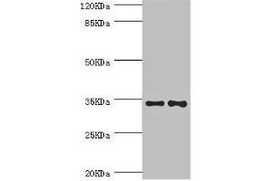 Western blot All lanes: NRBF2 antibody at 5.