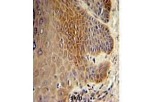 COL17A1 Antibody (Center) IHC analysis in formalin fixed and paraffin embedded skin tissue followed by peroxidase conjugation of the secondary antibody and DAB staining. (COL17A1 antibody  (Chain alpha 1, Middle Region))