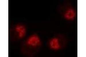 Immunofluorescent analysis of Dysbindin 1 staining in MCF7 cells. (DTNBP1 antibody)
