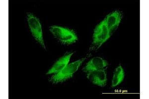 Immunofluorescence of purified MaxPab antibody to EPHX1 on HepG2 cell. (EPHX1 antibody  (AA 1-455))