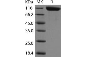 Western Blotting (WB) image for Alanyl (Membrane) Aminopeptidase (ANPEP) (Active) protein (His tag) (ABIN7194190) (CD13 Protein (His tag))