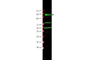 Western blot using  affinity purified anti-FANCA antibody shows detection of a band at ~133 kDa (arrowhead) corres-ponding to FANCA in HeLa whole cell lysates. (FANCA antibody  (AA 995-1009))