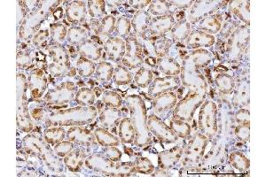 IHC analysis of CBR1 using anti-CBR1 antibody (ABIN7600015). (CBR1 antibody  (AA 14-262))
