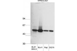 Image no. 1 for anti-Karyopherin alpha 2 (RAG Cohort 1, Importin alpha 1) (KPNA2) (AA 116-515) antibody (ABIN341119) (KPNA2 antibody  (AA 116-515))