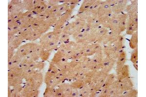 IHC image of ABIN7151025 diluted at 1:600 and staining in paraffin-embedded human heart tissue performed on a Leica BondTM system. (HACE1 antibody  (AA 333-442))