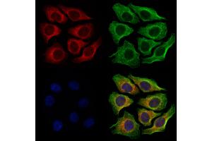 ABIN6263380 and ABIN6279011 staining Hela cells by IF/ICC.