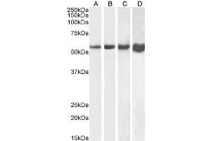 Western Blotting (WB) image for anti-Desmin (DES) (C-Term) antibody (ABIN334386)