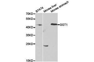 Western Blotting (WB) image for anti-gamma Glutamyltransferase 1 (GGT1) antibody (ABIN1872809) (GGT1 antibody)