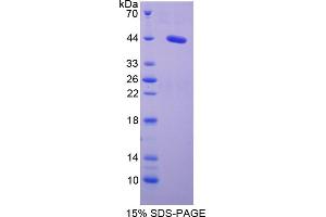 Image no. 1 for Serum Amyloid A2 (SAA2) (AA 20-122) protein (His tag,GST tag) (ABIN4988877)