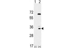 Western Blotting (WB) image for anti-EPH Receptor A10 (EPHA10) antibody (ABIN3003339) (EPH Receptor A10 antibody)