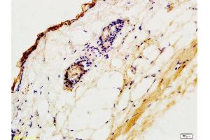 Formalin-fixed and paraffin embedded rat skin tissue labeled with Anti-CK2 Polyclonal Antibody,Unconjugated  at 1:200 followed by conjugation to the secondary antibody and DAB staining (Keratin 2 antibody  (AA 535-638))