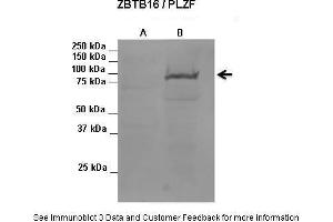 Lanes:   1. (ZBTB16 antibody  (C-Term))