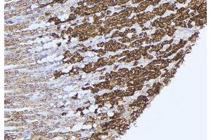 ABIN6277575 at 1/100 staining Human gastric tissue by IHC-P. (PCCB antibody  (Internal Region))