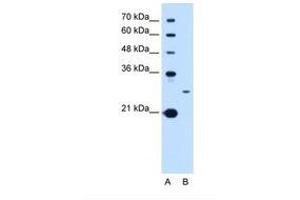 Tetraspanin 15 anticorps  (C-Term)