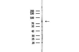 Western blot analysis of lysates from HepG2 cells(starvation,24h treatment), using Phospho-PI 3 Kinase p85 beta (Ser605) Antibody at 1/1000 dilution.