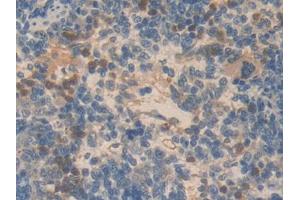DAB staining on IHC-P; Samples: Rat Spleen Tissue (SMAD6 antibody  (AA 171-441))