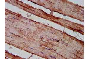 IHC image of ABIN7150930 diluted at 1:200 and staining in paraffin-embedded human skeletal muscle tissue performed on a Leica BondTM system. (Dystrophin antibody  (AA 3400-3558))