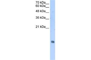 WB Suggested Anti-HIST2H2AA3 Antibody Titration:  2. (HIST2H2AA3 antibody  (Middle Region))