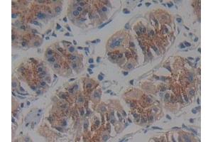 Immunohistochemistry (IHC) image for anti-Interferon alpha/beta Receptor 2 (IFNAR2) (AA 27-243) antibody (ABIN7435736)