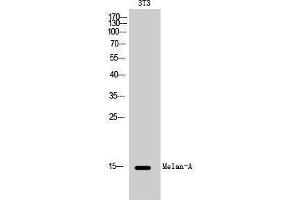 Western Blotting (WB) image for anti-Melan A (MLANA) (Internal Region) antibody (ABIN6280329) (MLANA antibody  (Internal Region))