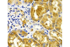 Immunohistochemistry of paraffin-embedded Human kidney using CDK20 Polyclonal Antibody at dilution of 1:100 (40x lens). (CCRK antibody)
