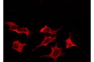 ABIN6276204 staining LOVO by IF/ICC. (GPR172B antibody  (Internal Region))