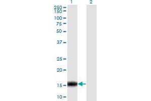 Western Blot analysis of C14orf129 expression in transfected 293T cell line by C14orf129 monoclonal antibody (M06), clone 2F2. (GSKIP antibody  (AA 1-139))
