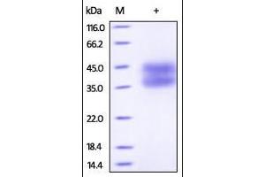 SDS-PAGE (SDS) image for Interleukin 2 Receptor, alpha (IL2RA) (AA 22-213) (Active) protein (His tag) (ABIN2181383) (CD25 Protein (AA 22-213) (His tag))