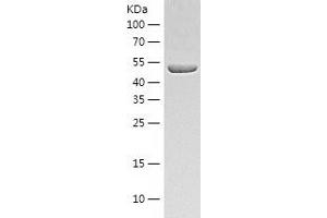 Western Blotting (WB) image for UDP-Glucose 6-Dehydrogenase (UGDH) (AA 1-493) protein (His tag) (ABIN7125648) (UGDH Protein (AA 1-493) (His tag))