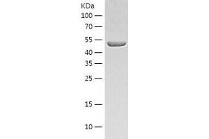 UGDH Protein (AA 1-493) (His tag)