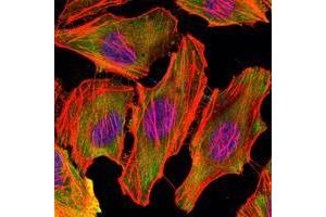 Immunofluorescence analysis of U251 cells using CSK mouse mAb (green). (CSK antibody)