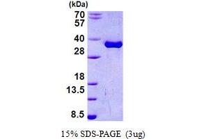 SDS-PAGE (SDS) image for Torsin Family 1, Member A (Torsin A) (TOR1A) (AA 21-332) protein (His tag) (ABIN5778838)