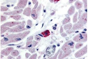 Anti-EMR3 antibody  ABIN1048549 IHC staining of human macrophage. (EMR3 antibody  (N-Term))