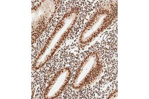 Immunohistochemical analysis of paraffin-embedded Human uterus tissue using (ABIN1537918 and ABIN2849884) performed on the Leica® BOND RXm.
