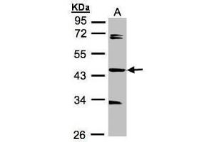 WB Image Sample A: 30μg of MOLT4 whole cell lysate , 10% SDS PAGE antibody diluted at 1:1000 (SDCCAG3 antibody  (Center))
