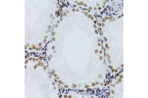 Immunohistochemistry (Paraffin-embedded Sections) (IHC (p)) image for anti-Nuclear Factor of kappa Light Polypeptide Gene Enhancer in B-Cells 2 (NFKB2) (AA 690-899) antibody (ABIN3017388)