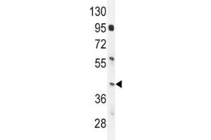 Western Blotting (WB) image for anti-Interferon Regulatory Factor 9 (IRF9) (AA 75-104) antibody (ABIN3031426)