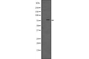 Western blot analysis of RIPK1 expression in Rat kidney tissue lysate ,The lane on the left is treated with the antigen-specific peptide. (RIPK1 antibody  (Internal Region))