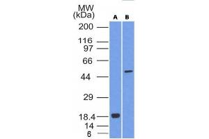 Image no. 1 for anti-SRY (Sex Determining Region Y)-Box 10 (SOX10) (AA 115-269) antibody (ABIN6181137) (SOX10 antibody  (AA 115-269))