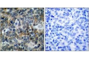 Immunohistochemistry analysis of paraffin-embedded human tonsil, using VASP (Phospho-Ser238) Antibody. (VASP antibody  (pSer239))