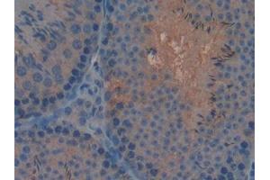 Immunohistochemistry (IHC) image for anti-Adenomatous Polyposis Coli (APC) (AA 2636-2845) antibody (ABIN7439342)