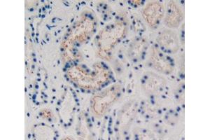 Used in DAB staining on fromalin fixed paraffin- embedded kidney tissue (KRT15 antibody  (AA 274-399))