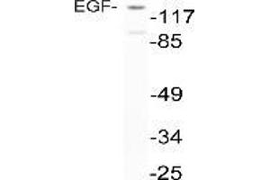 Western blot analysis of EGF in extracts from NIH-3T3 cells using anti-EGF antibody (EGF antibody)
