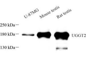 Western blot analysis of UGGT2 (ABIN7076141) at dilution of 1: 1000 (UGCGL2 antibody)