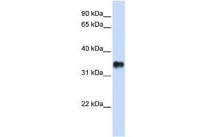 WB Suggested Anti-KCTD7 Antibody Titration:  0. (KCTD7 antibody  (N-Term))