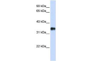 KCTD7 Antikörper  (N-Term)