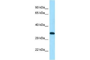 WB Suggested Anti-DSN1 Antibody Titration: 1. (DSN1 antibody  (N-Term))