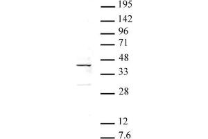 ATF4 antibody (pAb) tested by Western blot. (ATF4 antibody)