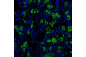 Immunofluorescence (IF) image for anti-CD68 Molecule (CD68) antibody (ABIN7449045) (Recombinant CD68 antibody)