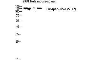Western Blot (WB) analysis of 293T HeLa Mouse Spleen lysis using Phospho-IRS-1 (S312) antibody. (IRS1 antibody  (pSer312))
